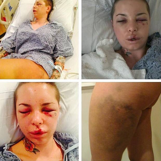 Atriz porno Christy Mack é espancada pelo lutador e namorado War Machine Fotos 1